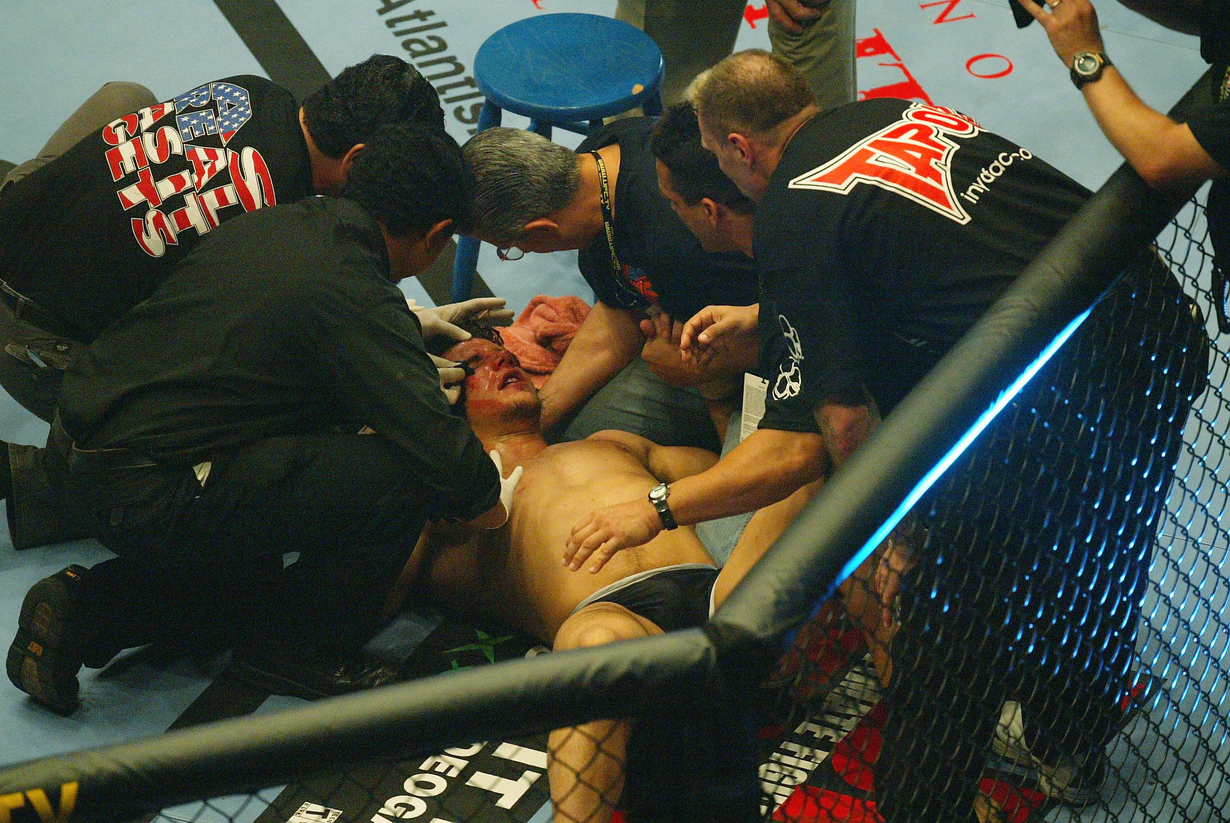LONDON - JULY 13:  Frank Mir of the USA gets treament after he fights with Ian Freeman of Great Britain and loses during the Ultimate Fighting Championship, "Brawl in the Royal Albert Hall", in the Royal Albert Hall London, England on July 13, 2002. (Photo by Mike Hewitt / Getty Images)