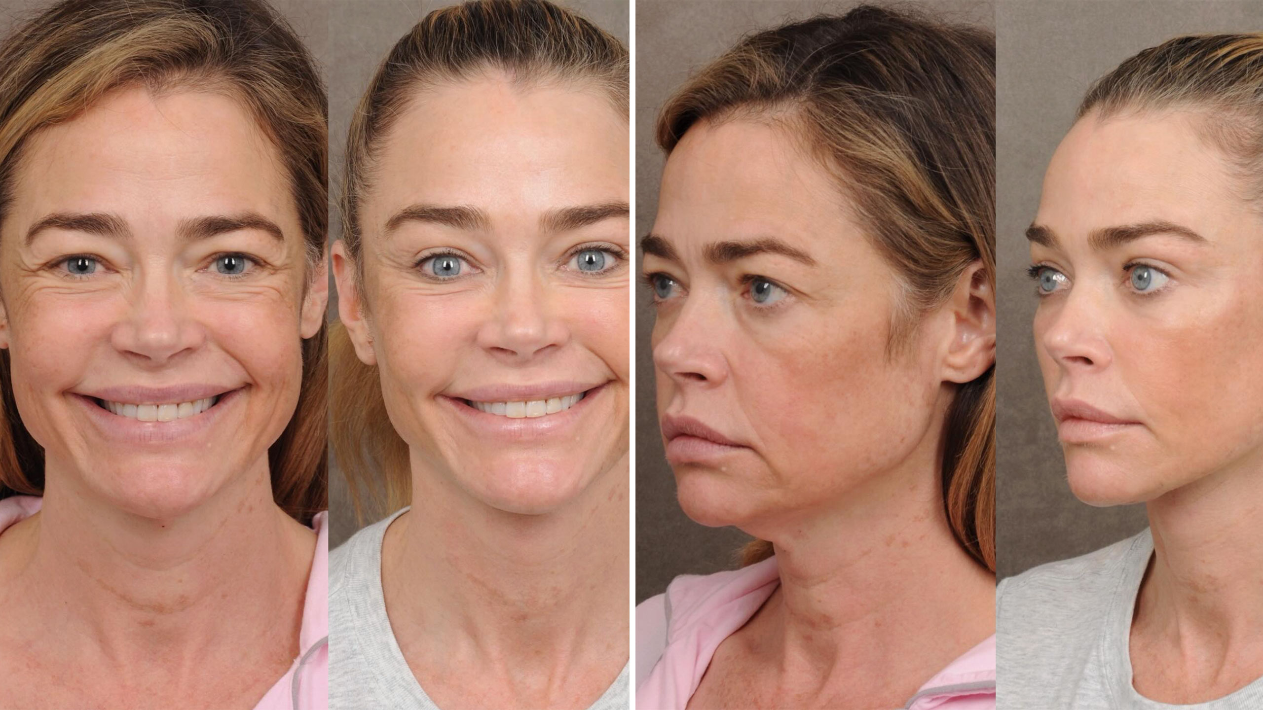 does denise richards smoke cigarettes in real life 🚨 STARTS TALKING ABOUT HER NEW FACELIFT — BUT PEOPLE IMMEDIATELY NOTICE SOMETHING ELSE, Watch closely. , What do you notice? denise richards smoke cigarettes did
