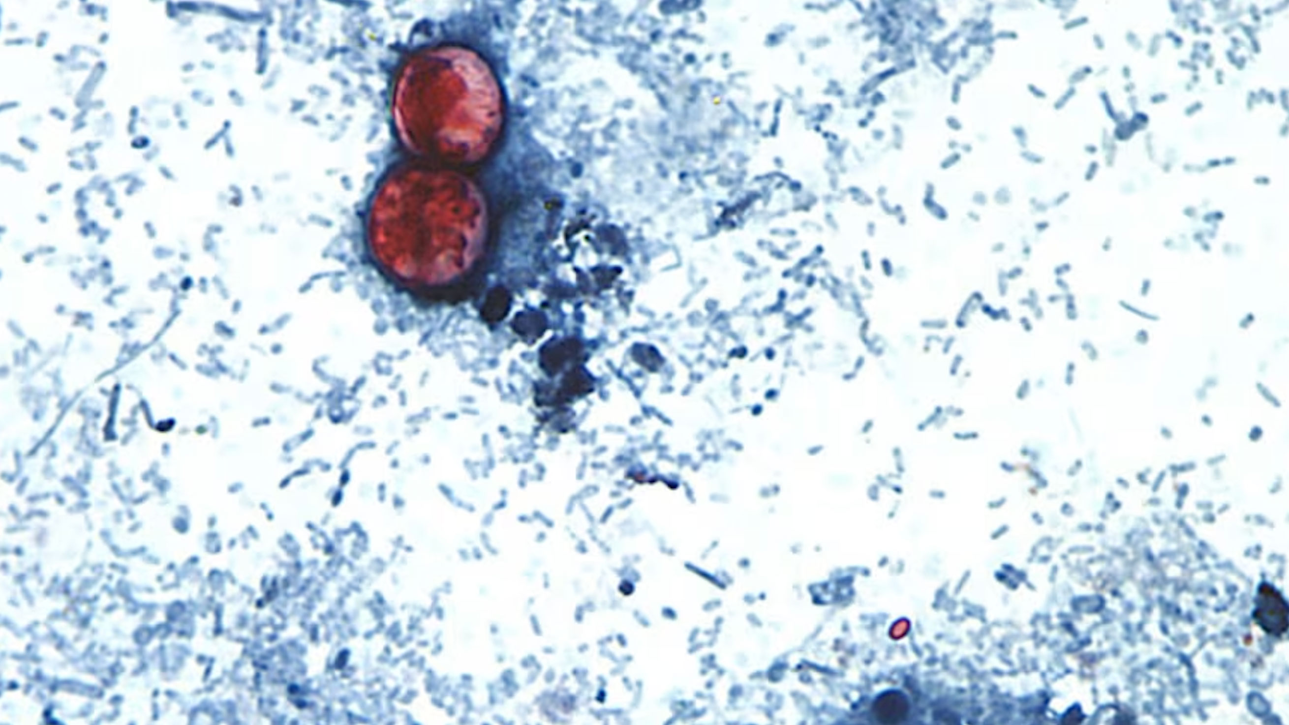 米ミシガン州で寄生虫による集団下痢症状が発生、当局が感染源を調査中